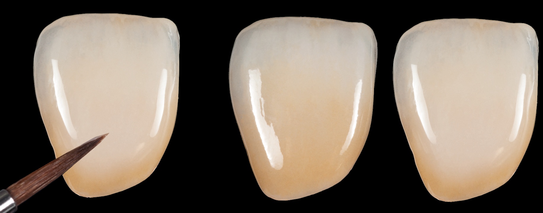 MIYO-ceramica lichida - AGC New Dent